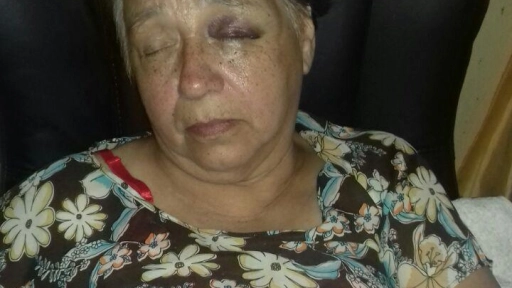Mujer que acudió a consultorio resultó fracturada tras caer desde la camilla