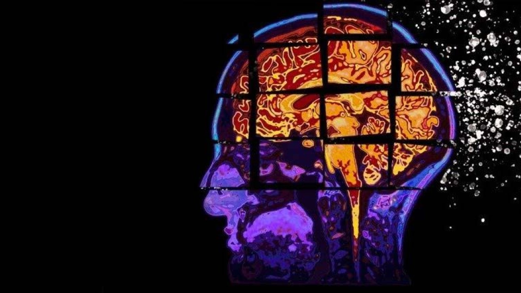 Alzheimer-cerebro-cabeza, 