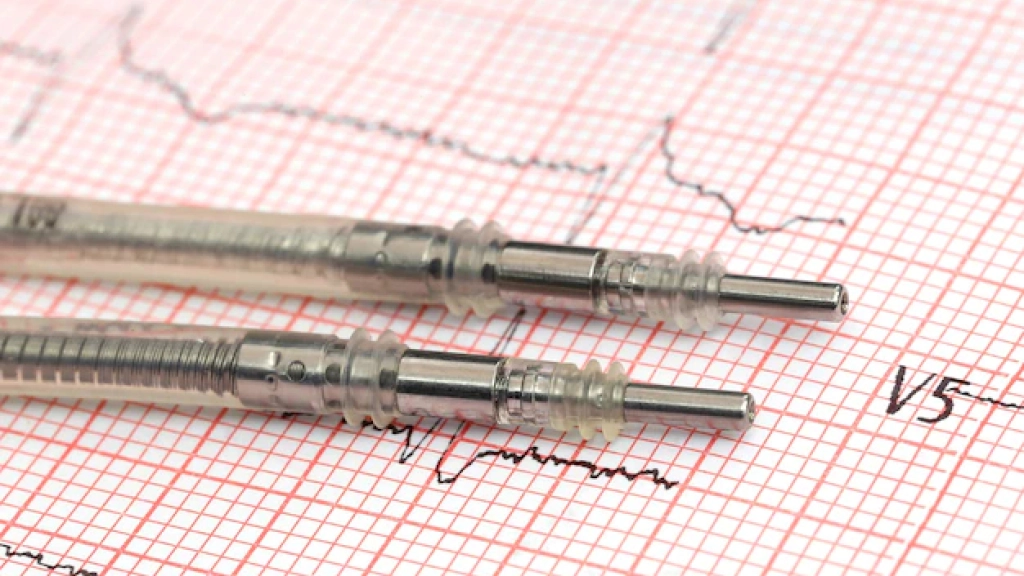 cerca-cables-marcapasos-electrocardiografo_525574-2501, 