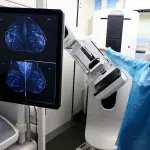 mamografía , cedida