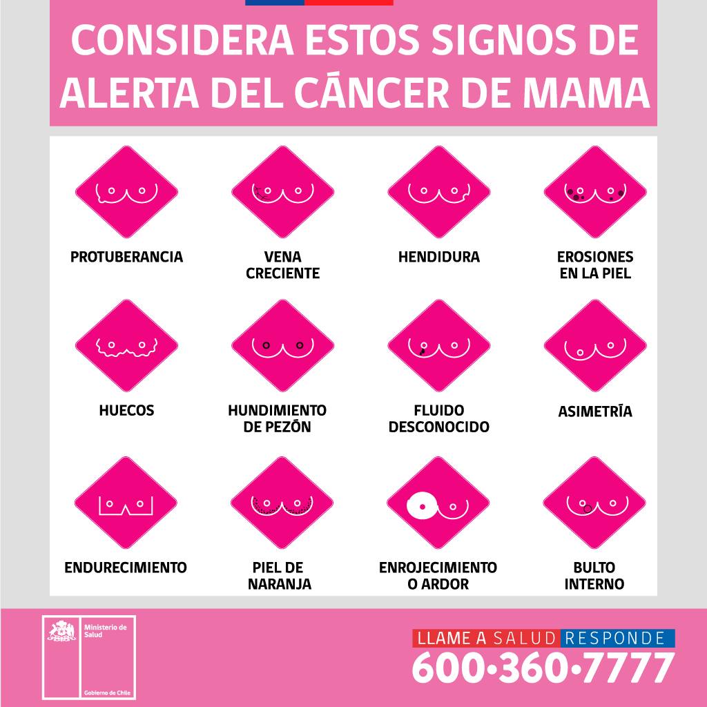 Signos de alerta cáncer de mama / @SaludResponde