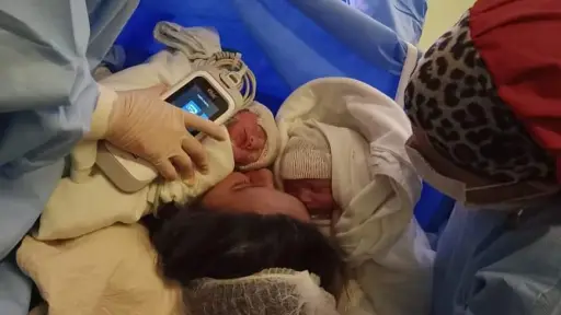 En Hospital de Angol nacen por primera vez trillizos