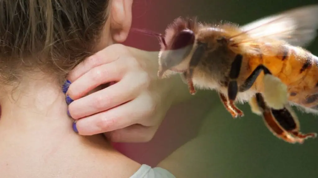  Ante cualquier reacción severa, debes acudir inmediatamente a un centro de urgencia., contexto