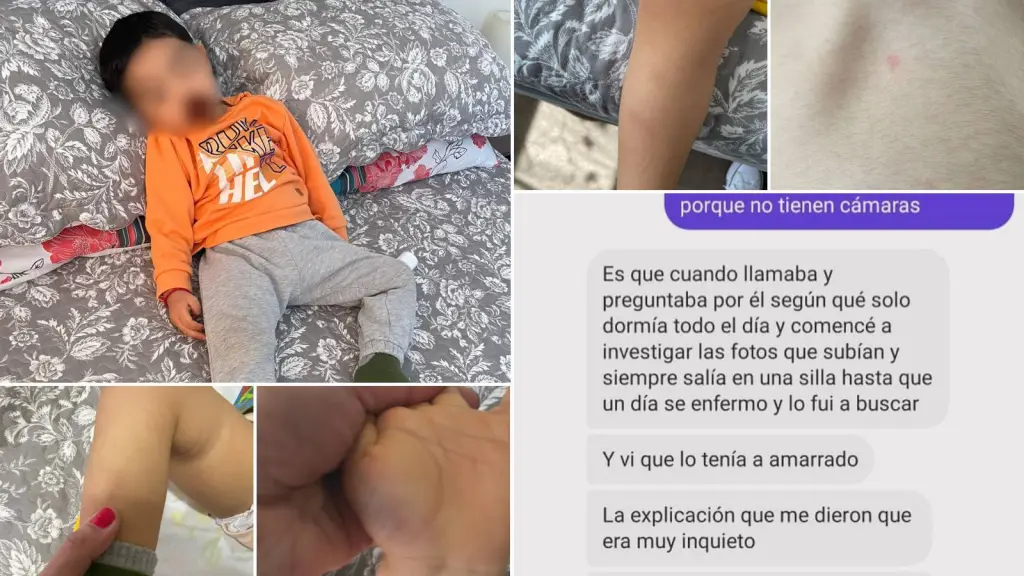 Madre denuncia maltrato a su hijo con TEA en jardín infantil de Los Ángeles, Cedida