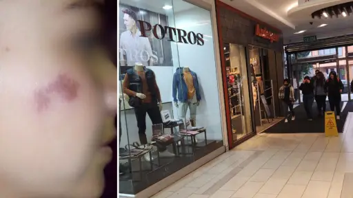 Rociada con gas pimienta: Trabajadora de Mall Plaza reclama falta de seguridad tras sufrir ataque de delincuente 