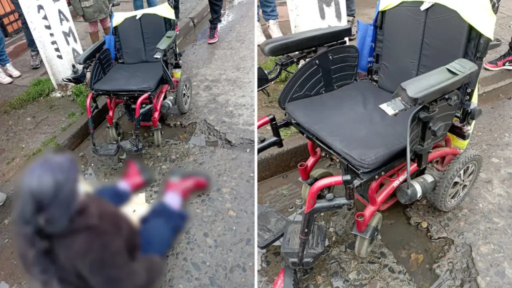 Con fracturas en sus piernas: El drama de mujer mayor que cayó de su silla ruedas en “peligrosa” calle angelina