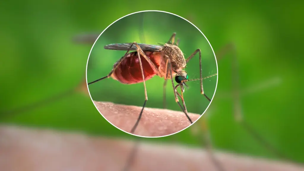 De acuerdo con los antecedentes, estas son las primeras muertes que se registran sobre esta enfermedad a nivel mundial. , Contexto