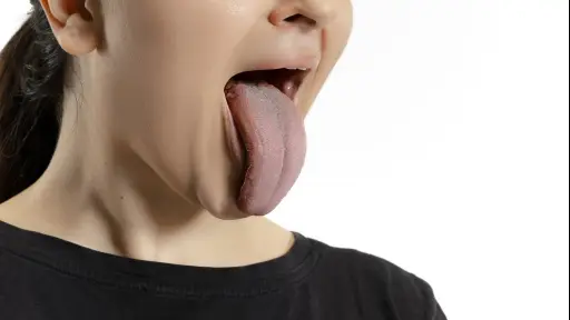 ¿Cómo una lengua sana muestra un óptimo estado de salud?