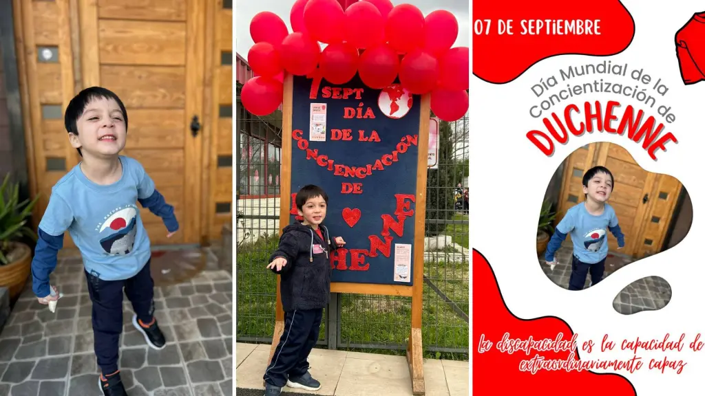 Madre pide empatía en Día Nacional de la Distrofia muscular de Duchenne