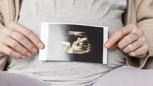 Madre visibiliza el dolor de mujeres que perdieron a un hijo en etapa de gestación