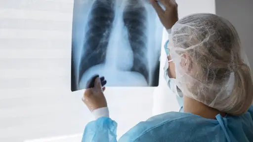 ¿Qué es la fibrosis pulmonar y la silicosis?: las dos enfermedades que padecía Mario Gómez
