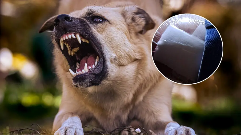 mordedura de perro, Rossana Puentes