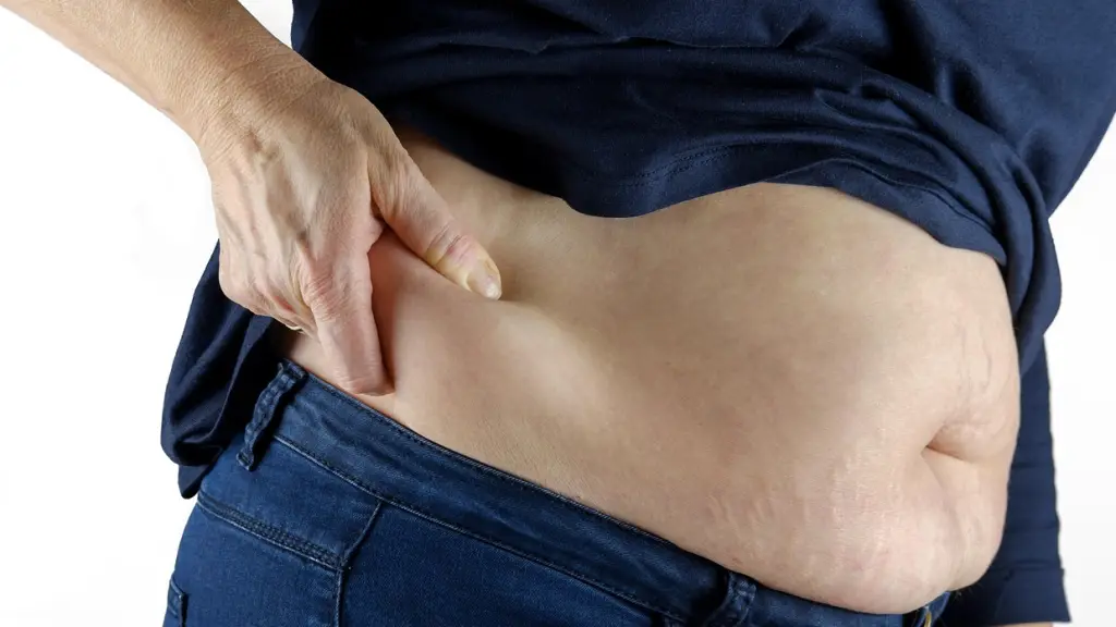 obesidad, gordo, exceso de peso, Pixabay