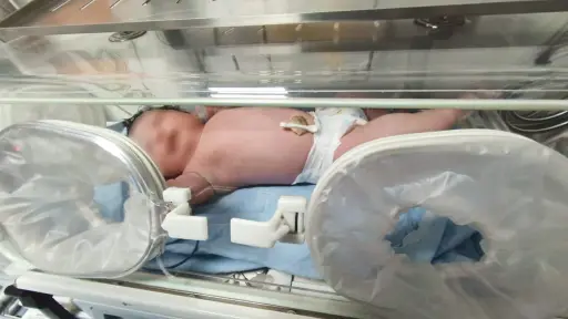 Amanda, la bebé de cinco kilos que nació en Los Ángeles tras embarazo de alto riesgo