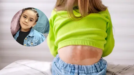 Familia lajina organiza cruzada solidaria para costear exámenes y tratamiento de su hija con enfermedad poco común