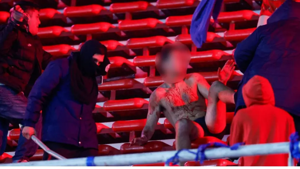 Actualización: Asciende a seis los hinchas angelinos de la U que resultaron heridos en Argentina, La Tribuna