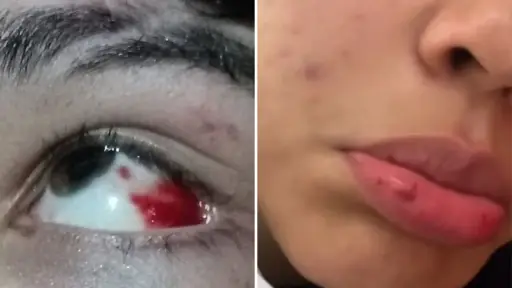 Denuncian hechos de violencia en colegio de Santa Bárbara: sostenedor inició una investigación interna