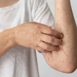 El período de incubación de la varicela puede extenderse desde los diez hasta los 21 días, dependiendo de la carga viral a la que se expuso la persona / Contexto, Freepik