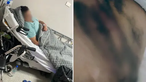 Paciente espera operación tras fallo judicial: Servicio de Salud asegura que ha cumplido con resolución