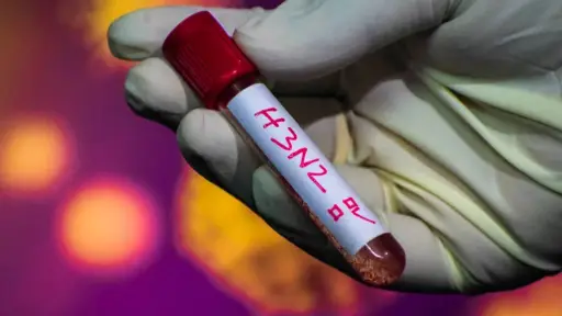 Detectan subclado K de influenza A(H3N2) en Chile: autoridades llaman a mantener la calma