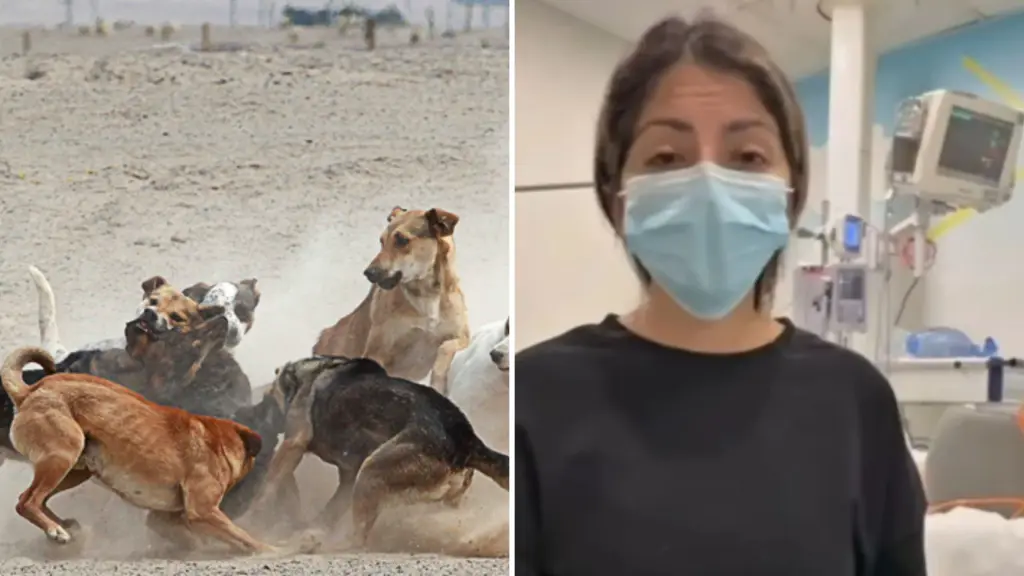 “Fue mordida más de 130 veces”: madre denuncia brutal ataque de perros contra su hija de 10 años y pide justicia, Diario La Tribuna