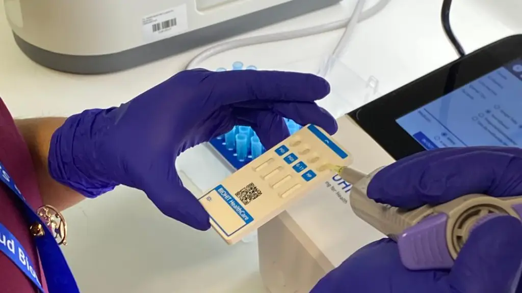 El equipo clínico del complejo angelino ya procesó las primeras 1.000 muestras, que arrojaron que un 42% de los usuarios analizados presenta sospechas de infección por la bacteria Helicobacter pylori., Cedida