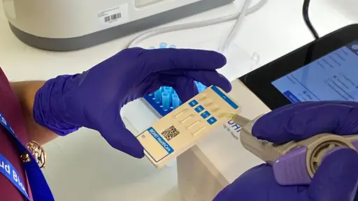 Hospital Base de Los Ángeles incorpora examen de sangre para priorizar urgencias por cáncer gástrico 