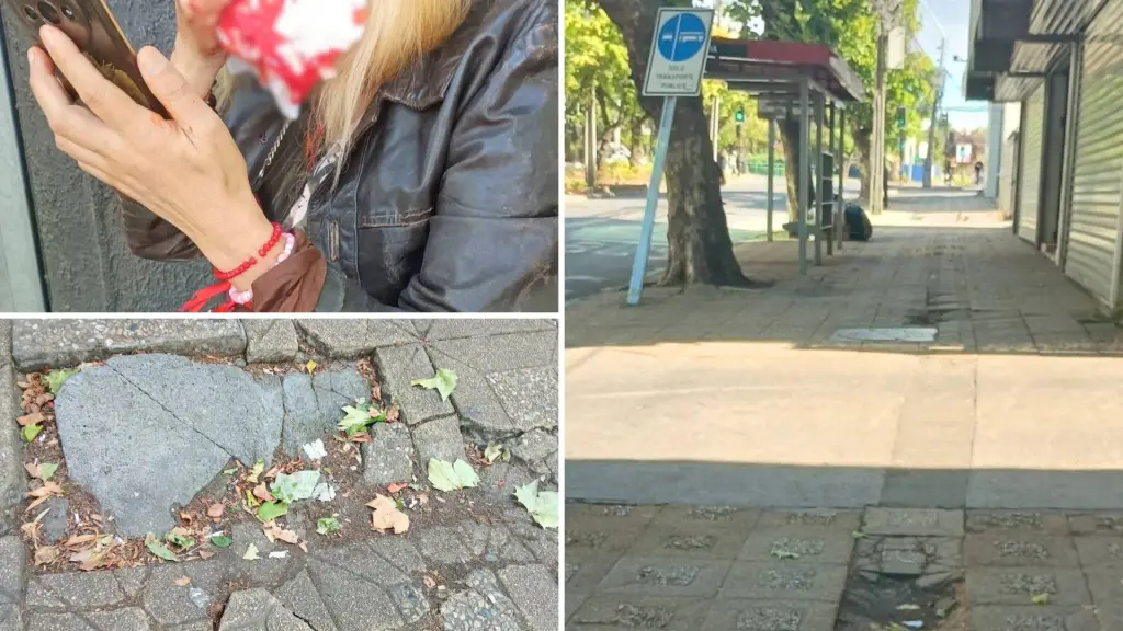 Marta, de 58 años, presenta fractura nasal tras su caída en calle Valdivia en el centro de Los Ángeles, luego de tropezar con desniveles en la acera. , Cedidas