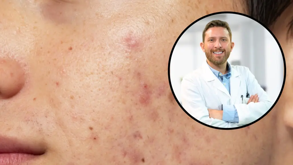 Acné y Sol, Diario La Tribuna