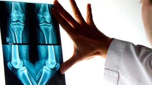 Traumatología: la especialidad médica clave para una vida activa y sin limitaciones