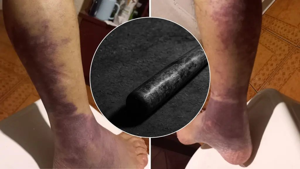 Pareja de adultos mayores fueron agredidos por sus vecinos con un bate y golpes de puño en Los Ángeles, Diario La Tribuna