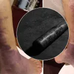 Pareja de adultos mayores fueron agredidos por sus vecinos con un bate y golpes de puño en Los Ángeles, Diario La Tribuna