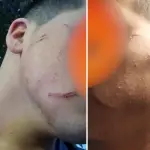 Joven de 14 años fue agredido con arma blanca en las inmediaciones de liceo de Tucapel, La Tribuna 