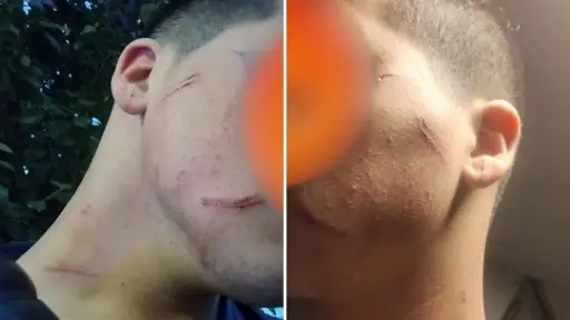 Joven de 14 años es agredido con arma blanca a las afueras de liceo de Tucapel
