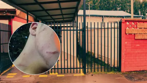 Con resguardo de Carabineros queda liceo tras ataque con arma blanca a joven de 14 años en Tucapel