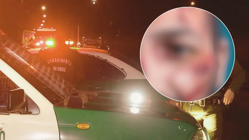 Mútiples fracturas faciales: Hombre agredió y dejó con lesiones graves a su padrastro en Alto Biobío, La Tribuna 