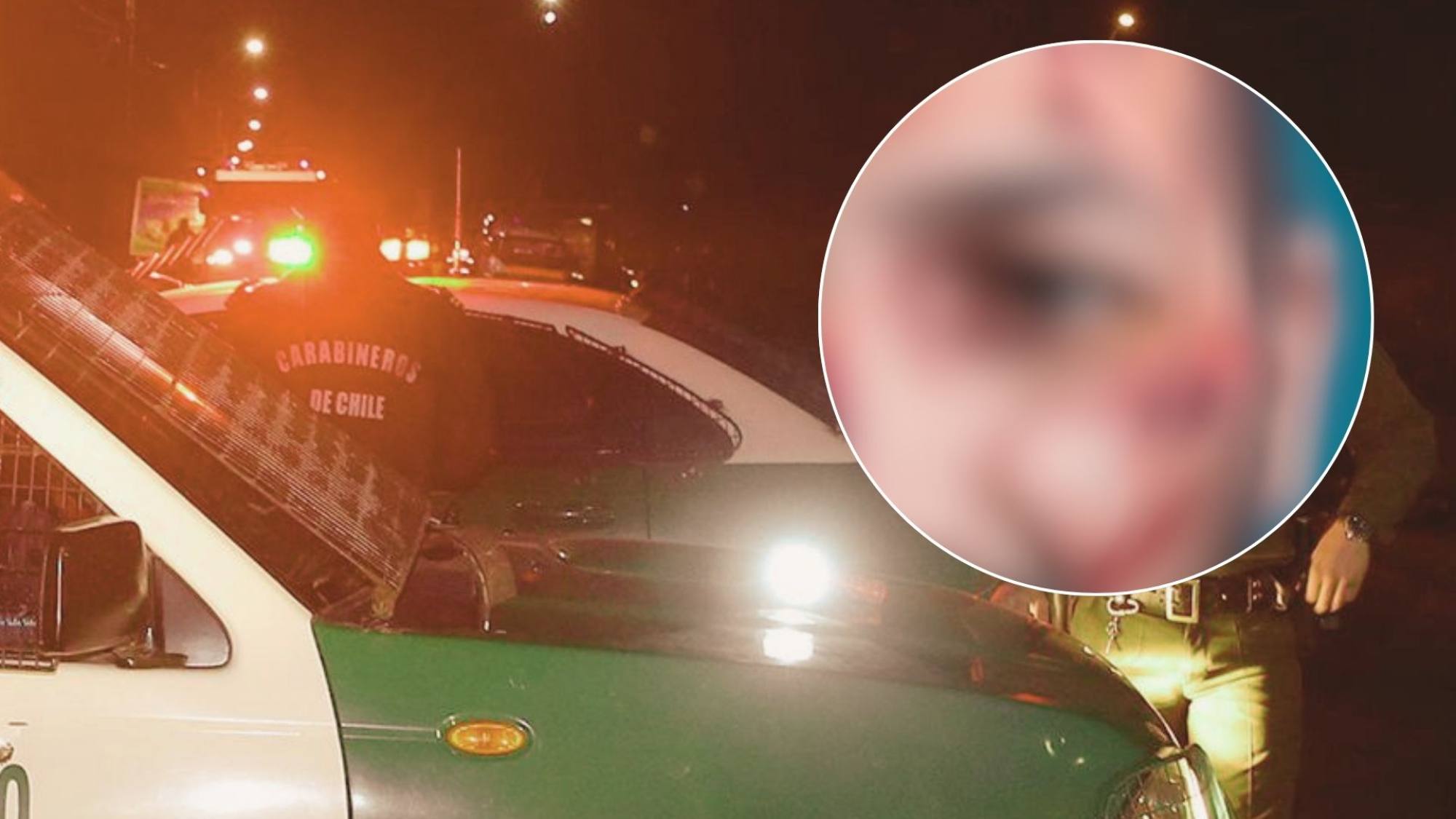 Mútiples fracturas faciales: Hombre agredió y dejó con lesiones graves a su padrastro en Alto Biobío