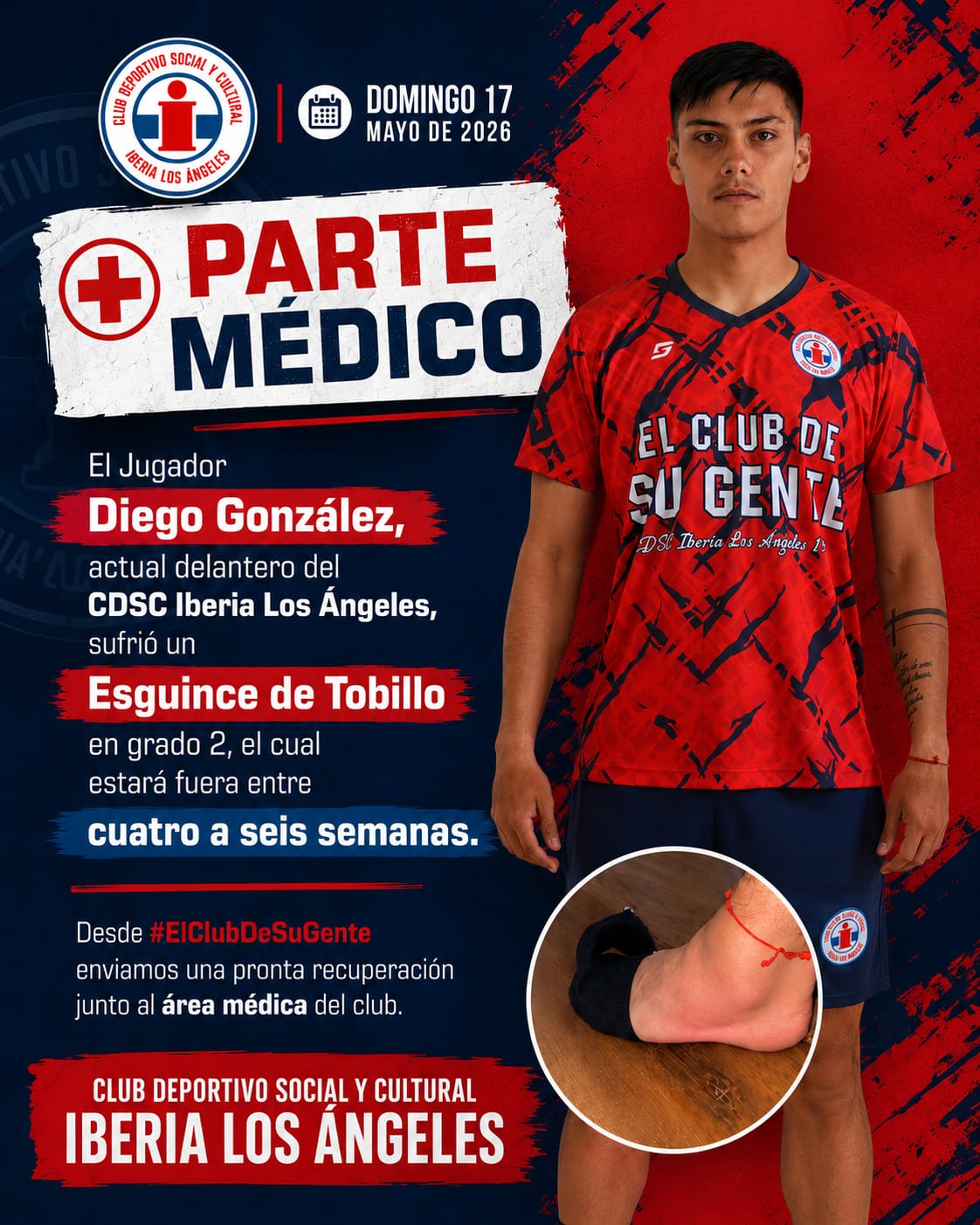 Al cierre de la edición de La Tribuna, el club daba cuenta del parte médico del jugador / CDSC Iberia