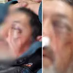 Hombre quedó con fractura ocular tras ser agredido en Los Ángeles: “Tuvo que ser trasladado a Santiago”, La Tribuna