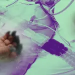 Demandan al Hospital de Los Ángeles por presunta negligencia tras cirugía que derivó en amputaciones a paciente, La Tribuna
