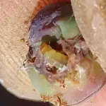 La instalación de confusores sexuales contra la polilla de la vid (Lobesia botrana) busca resguardar la sanidad vegetal de vid y arándanos.