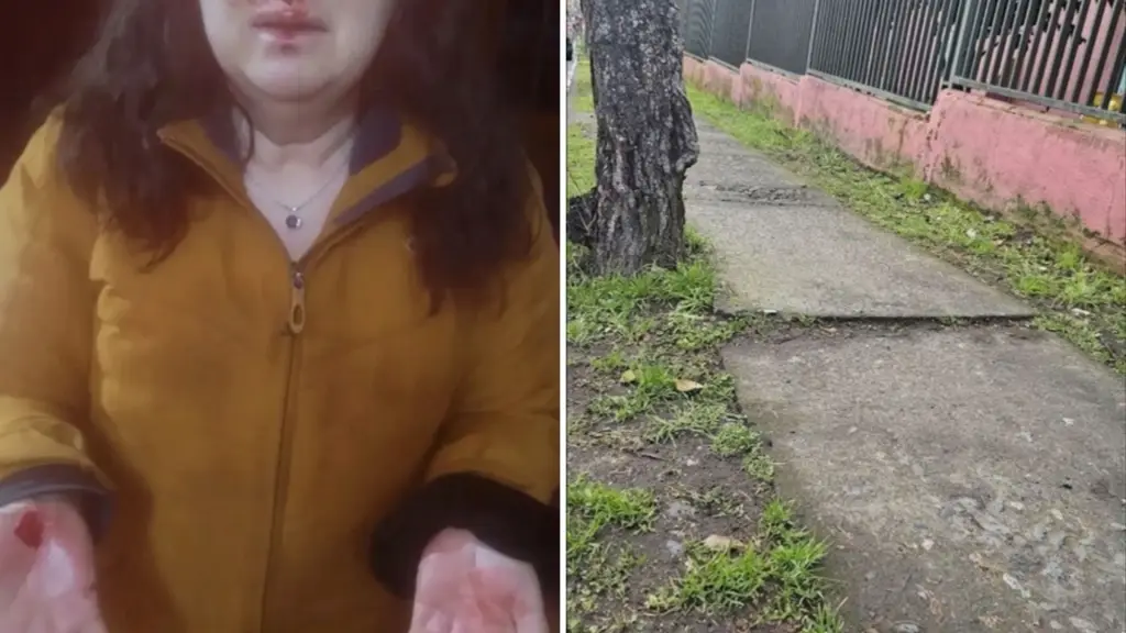 Mujer terminó con lesiones graves y su nariz fracturada tras tropezar en vereda en mal estado en Nacimiento, Soy_Nacimentano | Instragram